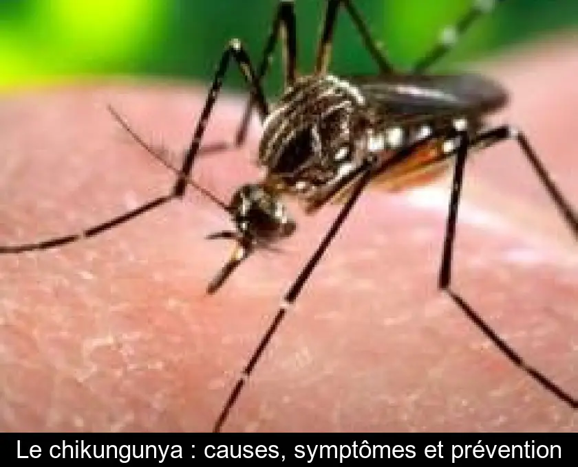 Le chikungunya : causes, symptômes et prévention