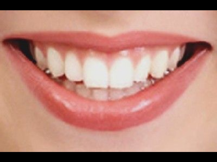 Le détartrage des dents : un geste de santé et de beauté Le détartrage des dents : un geste de santé et de beauté