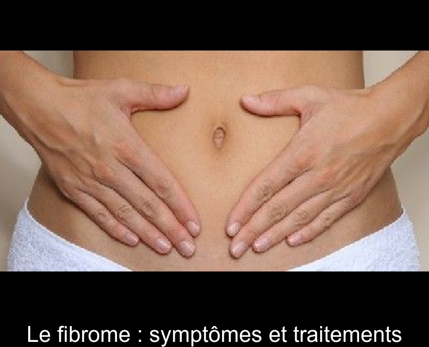 Le fibrome : symptômes et traitements Le fibrome : symptômes et traitements