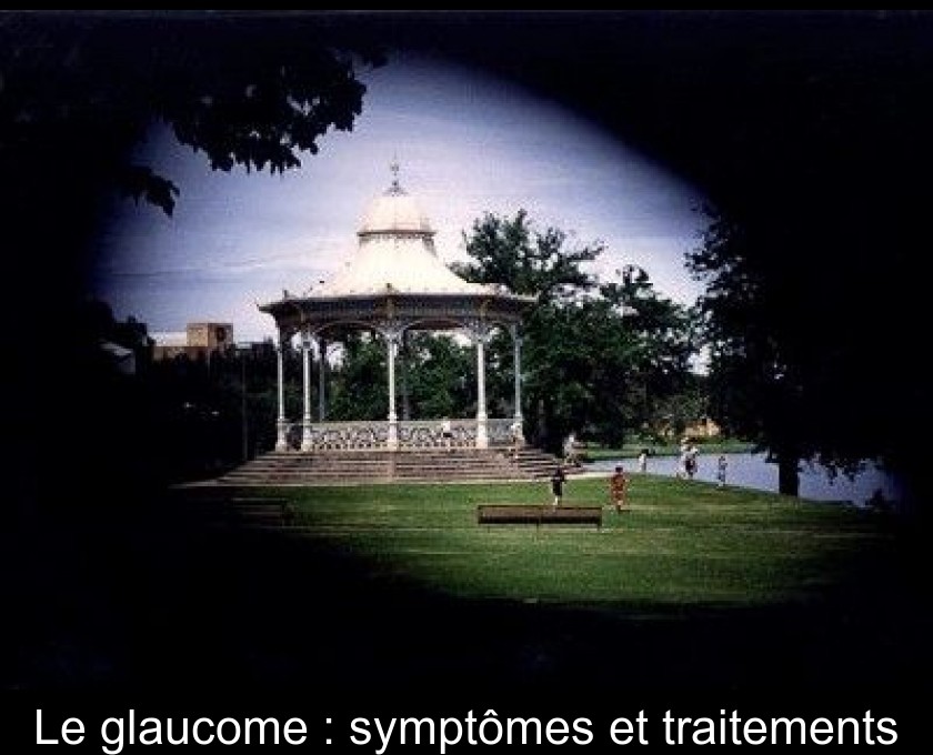 Le glaucome : symptômes et traitements Le glaucome : symptômes et traitements