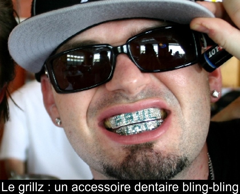 Grillz (prothèse dentaire décorative en or) - Dr Sylvain