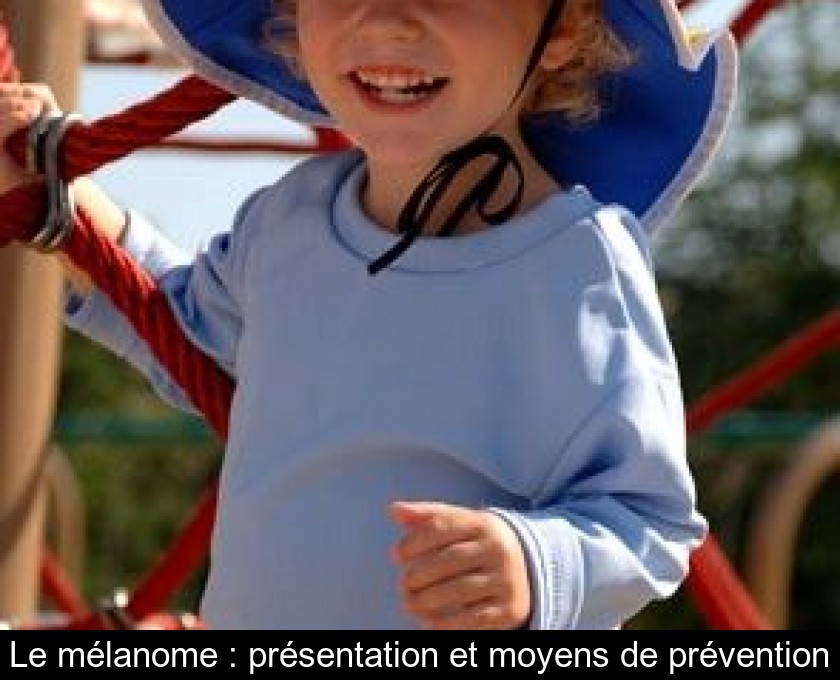 Le mélanome : présentation et moyens de prévention Le mélanome : présentation et moyens de prévention