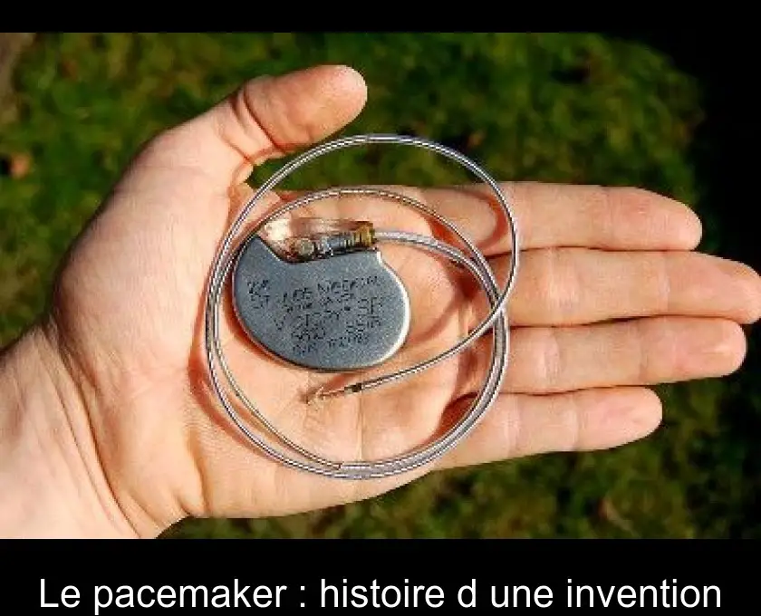 Le pacemaker : histoire d'une invention