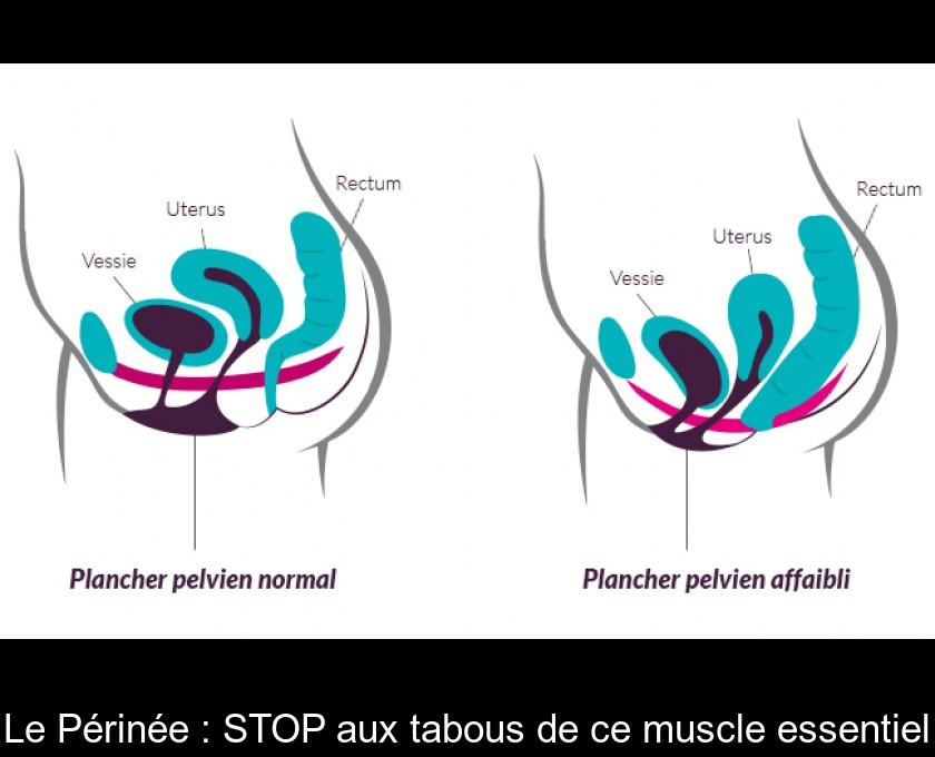 Le Périnée : STOP aux tabous de ce muscle essentiel Le Périnée : STOP aux tabous de ce muscle essentiel