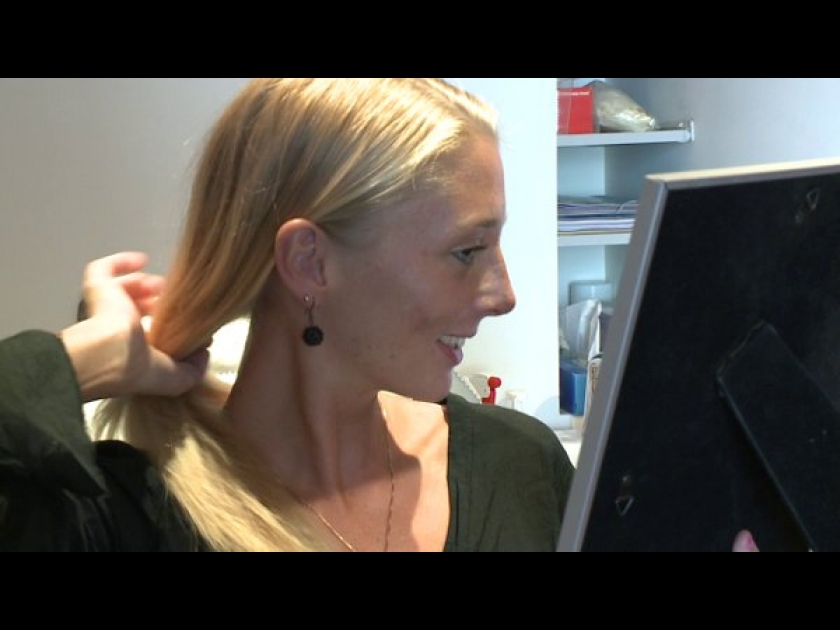 Le résultat d'une rhinoplastie en vidéo Le résultat d'une rhinoplastie en vidéo