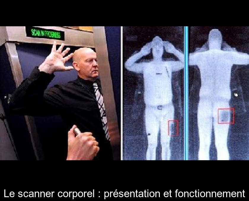 Le scanner corporel : présentation et fonctionnement Le scanner corporel : présentation et fonctionnement
