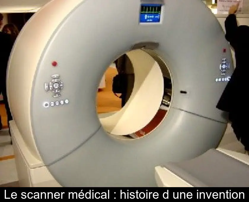 Le scanner médical : histoire d'une invention