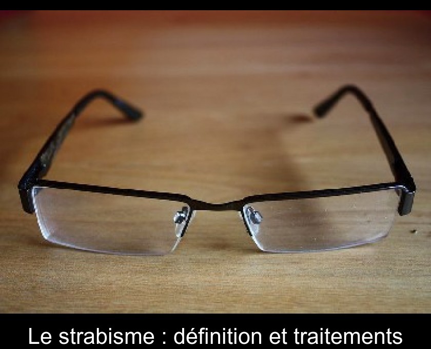 Le strabisme : définition et traitements Le strabisme : définition et traitements