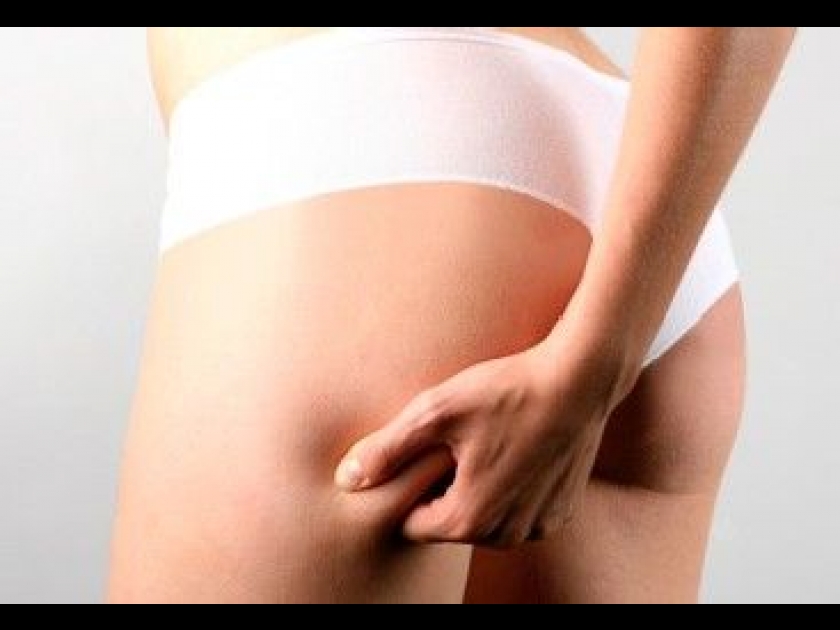 Le traitement de la cellulite Le traitement de la cellulite
