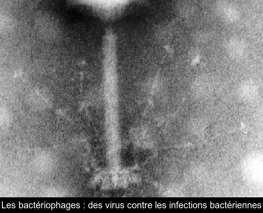 Les bactériophages : des virus contre les infections bactériennes