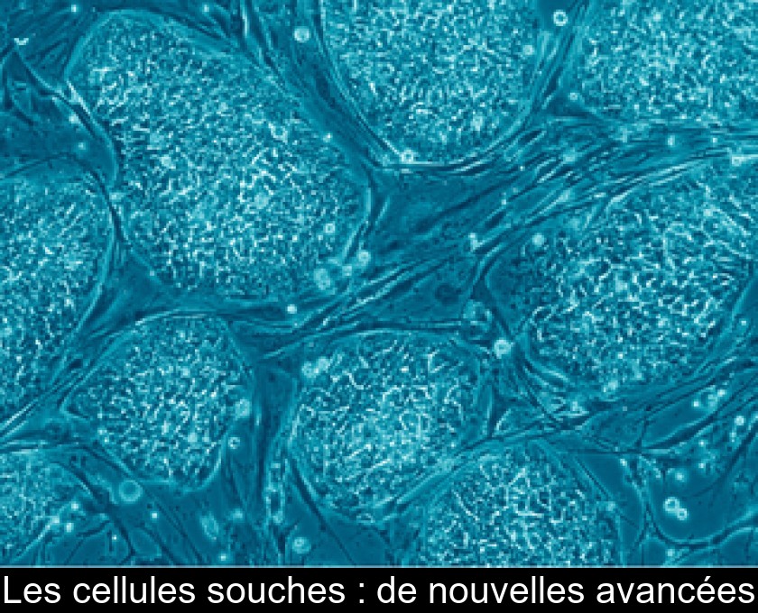 Les cellules souches : de nouvelles avancées Les cellules souches : de nouvelles avancées