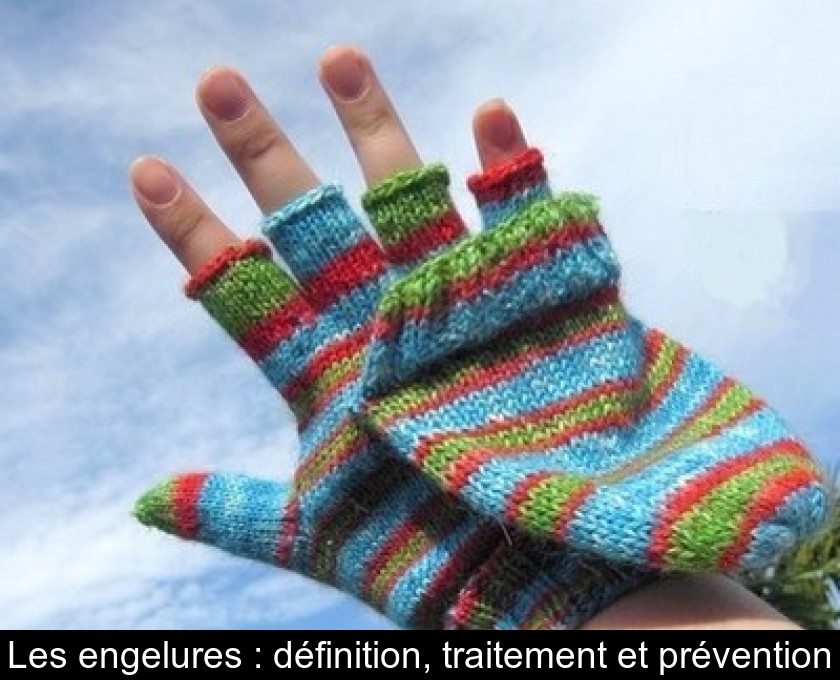 Les engelures : définition, traitement et prévention Les engelures : définition, traitement et prévention