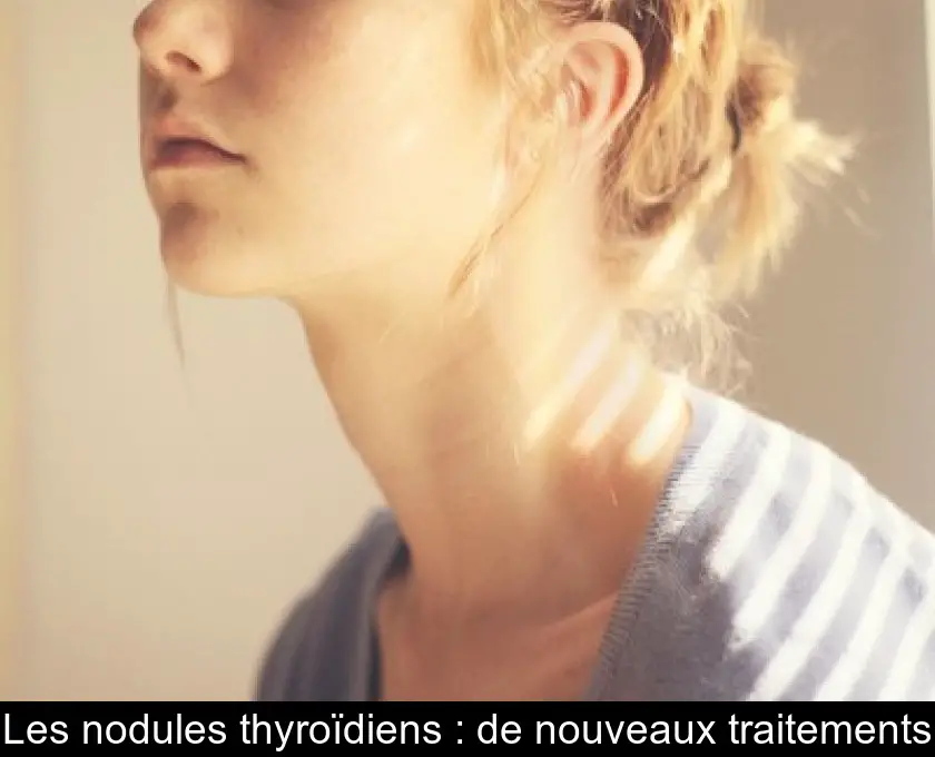 Les nodules thyroïdiens : de nouveaux traitements