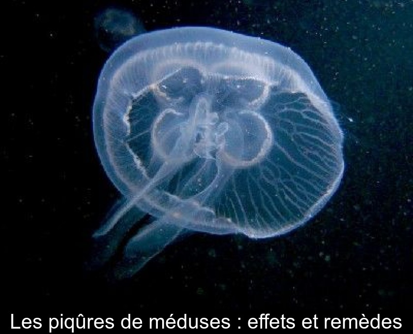 Les piqûres de méduses : effets et remèdes Les piqûres de méduses : effets et remèdes