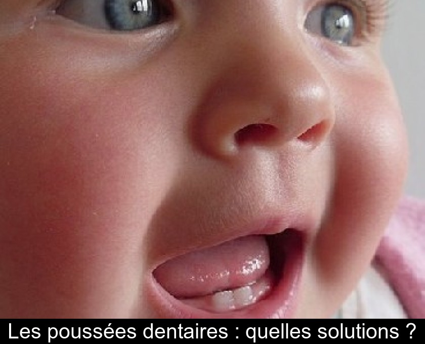 Dents bébé qui percent : Symptômes et soulager bébé.