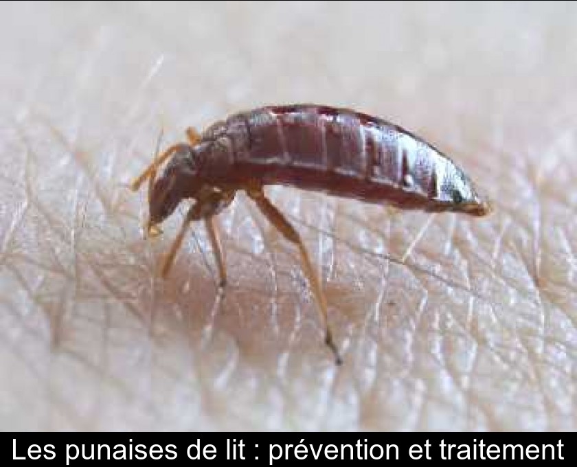 Les punaises de lit : prévention et traitement Les punaises de lit : prévention et traitement