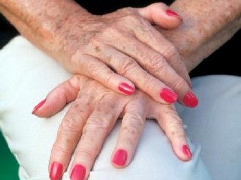 Les taches brunes sur la peau : causes et solutions Les taches brunes sur la peau : causes et solutions