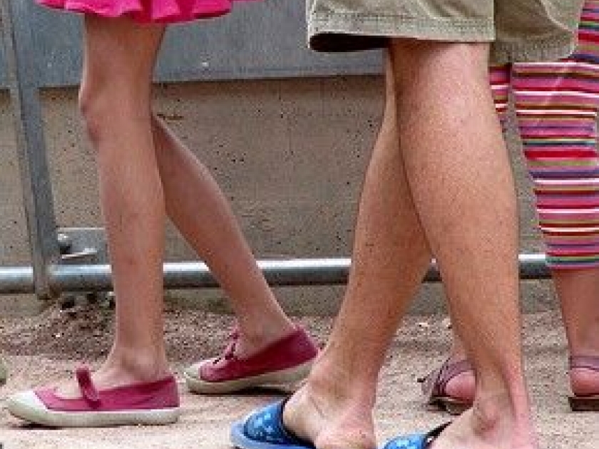 Les varices : prévention et traitement Les varices : prévention et traitement