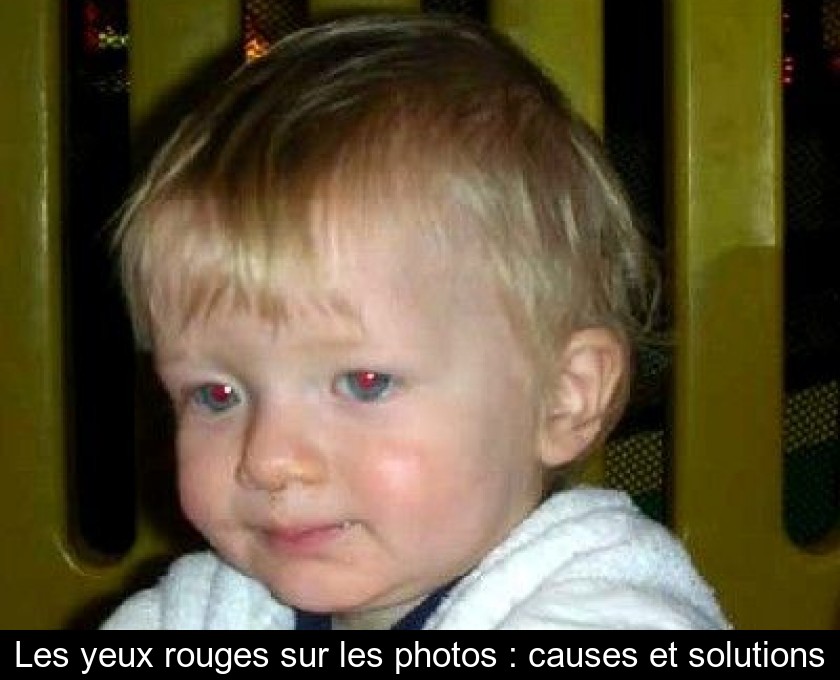 Les yeux rouges sur les photos : causes et solutions Les yeux rouges sur les photos : causes et solutions