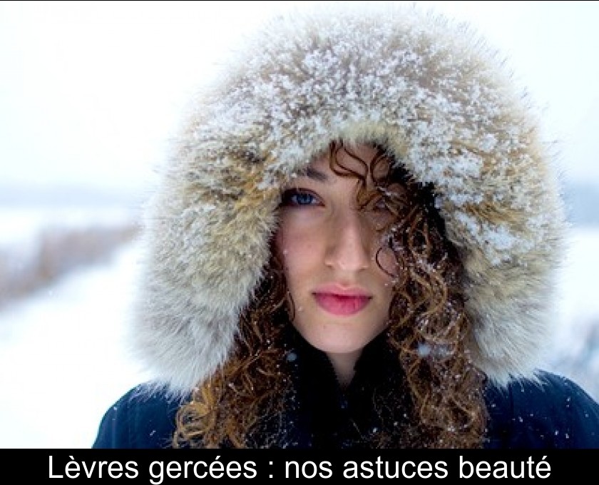 Lèvres gercées : nos astuces beauté Lèvres gercées : nos astuces beauté
