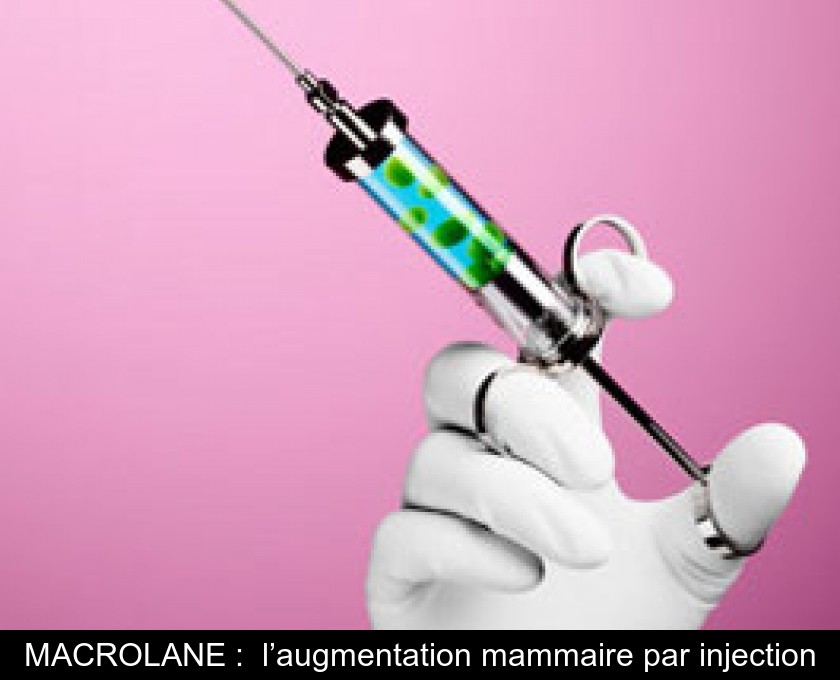 MACROLANE : l’augmentation mammaire par injection MACROLANE : l’augmentation mammaire par injection