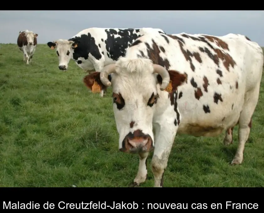 Maladie de Creutzfeld-Jakob : nouveau cas en France 