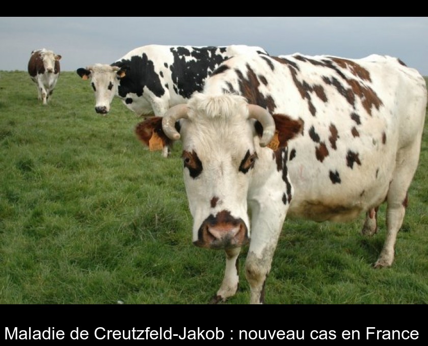 Maladie de Creutzfeld-Jakob : nouveau cas en France Maladie de Creutzfeld-Jakob : nouveau cas en France