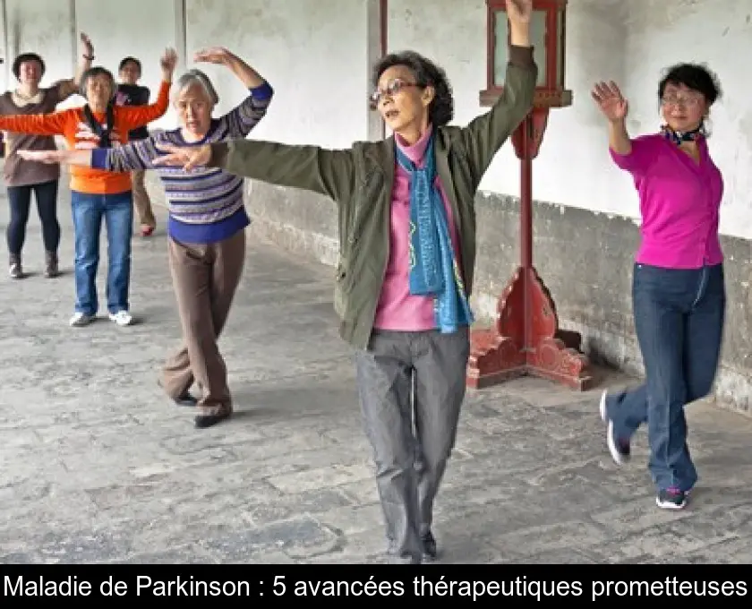 Maladie de Parkinson : 5 avancées thérapeutiques prometteuses