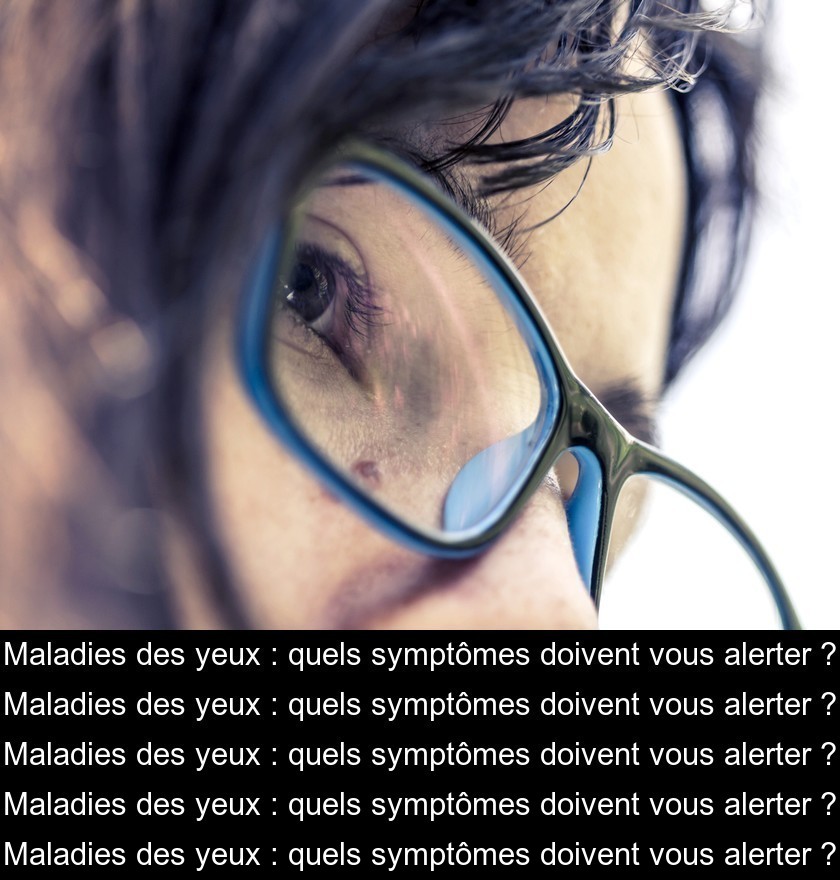 Maladies des yeux : quels symptômes doivent vous alerter ?