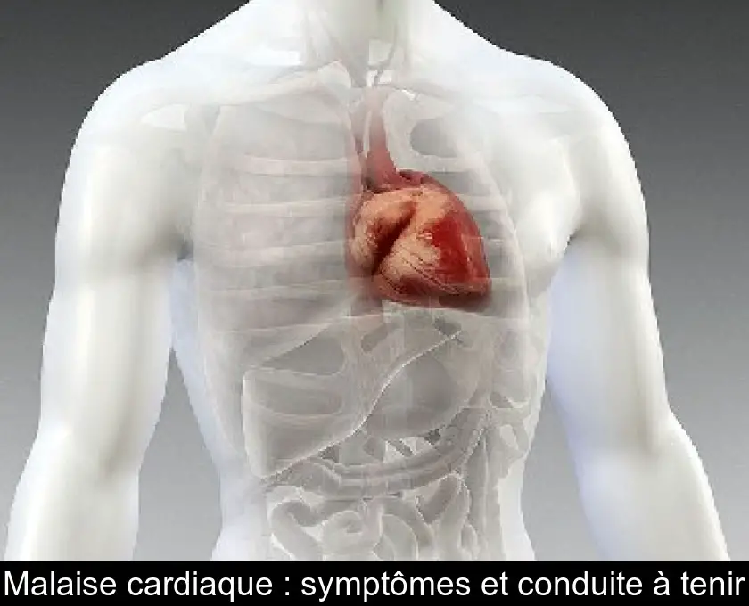 Malaise cardiaque : symptômes et conduite à tenir