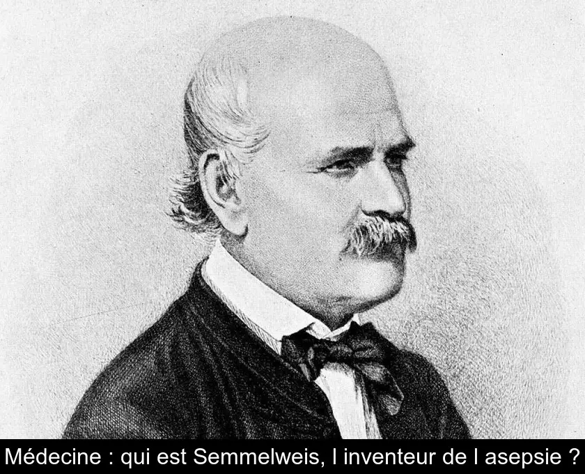 Médecine : qui est Semmelweis, l'inventeur de l'asepsie ?