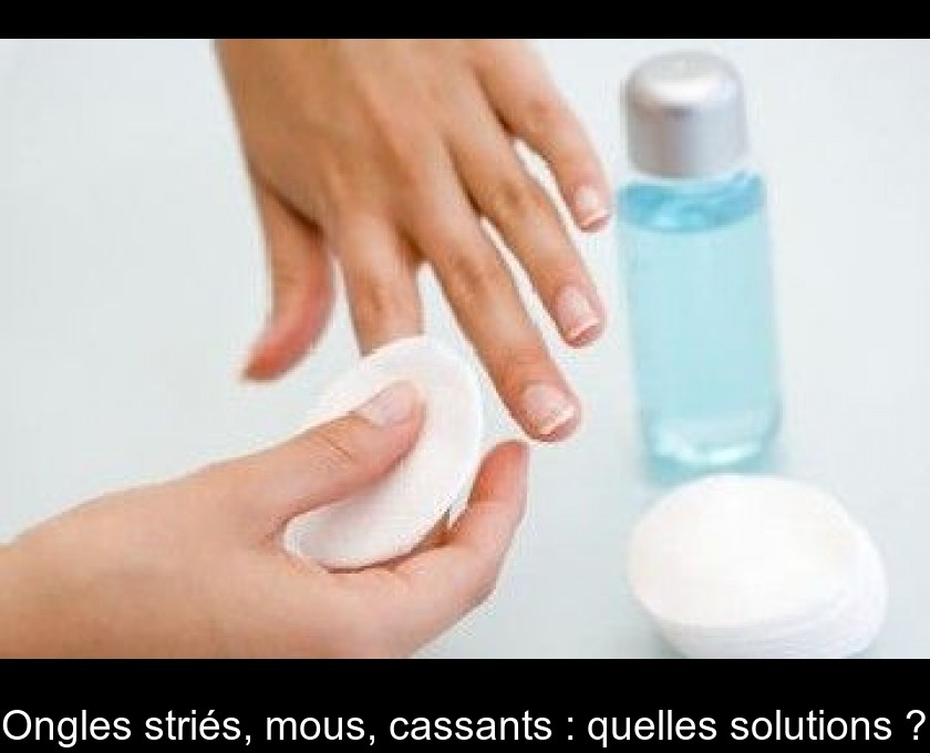 Ongles striés, mous, cassants : quelles solutions ? Ongles striés, mous, cassants : quelles solutions ?