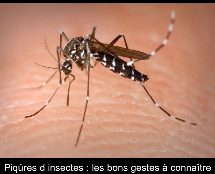 Piqûres d'insectes : les bons gestes à connaître Piqûres d'insectes : les bons gestes à connaître