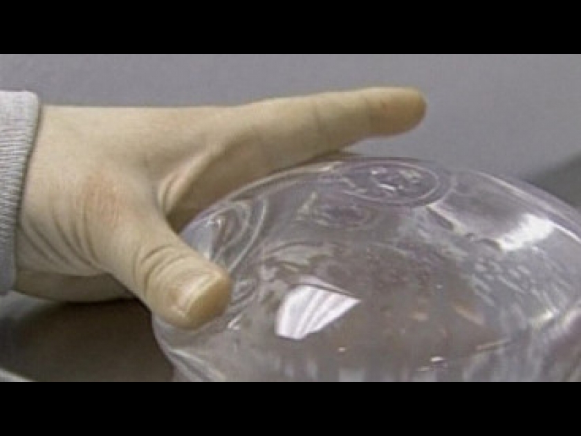 PROTHESES MAMMAIRES : Comment choisir ses implants ? PROTHESES MAMMAIRES : Comment choisir ses implants ?