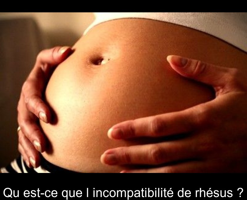Qu'est-ce que l'incompatibilité de rhésus ? Qu'est-ce que l'incompatibilité de rhésus ?