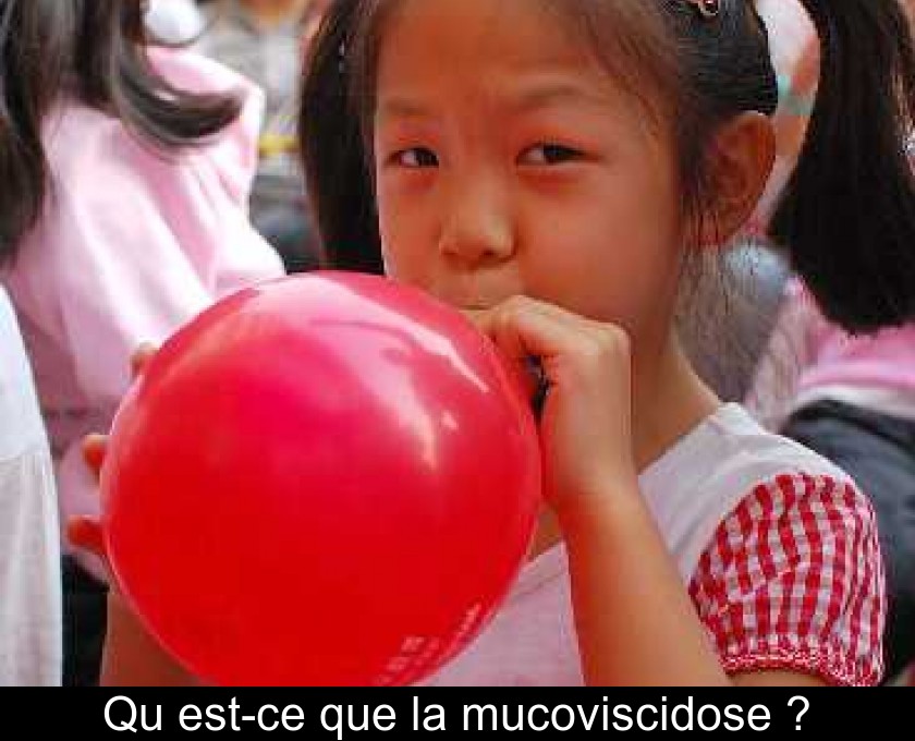 Qu'est-ce que la mucoviscidose ? Qu'est-ce que la mucoviscidose ?