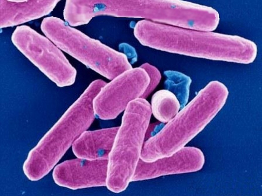 Santé : quelles différences entre microbe, virus et bactérie ? Santé : quelles différences entre microbe, virus et bactérie ?