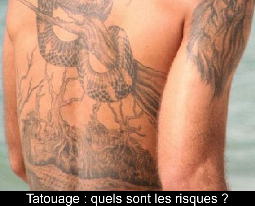 Tatouage : quels sont les risques ? Tatouage : quels sont les risques ?