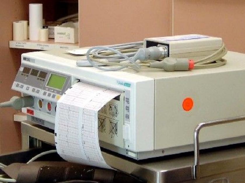 Tout savoir sur l'électrocardiogramme Tout savoir sur l'électrocardiogramme