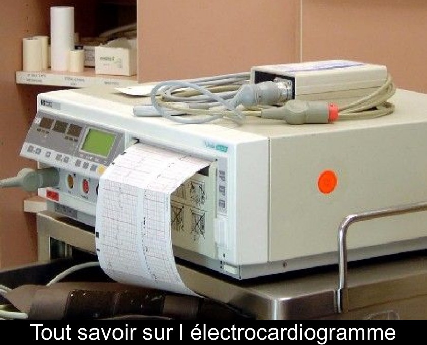 Tout savoir sur l'électrocardiogramme Tout savoir sur l'électrocardiogramme