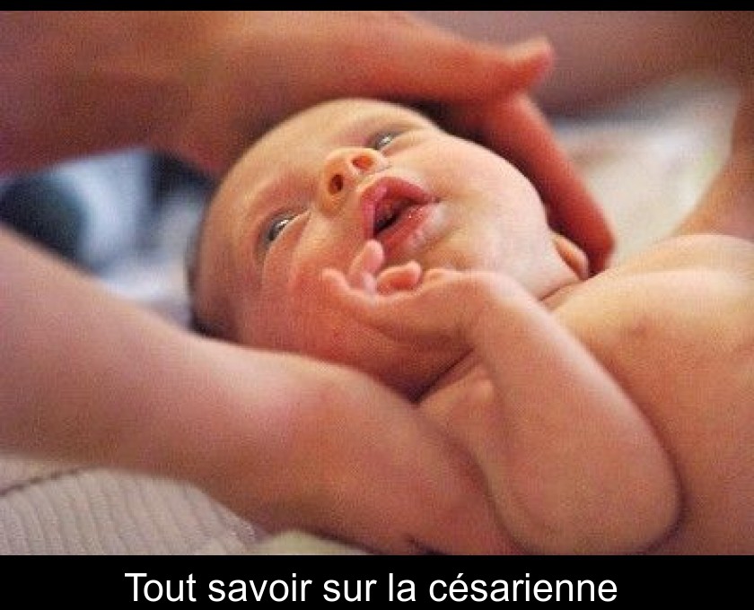 Tout savoir sur la césarienne Tout savoir sur la césarienne