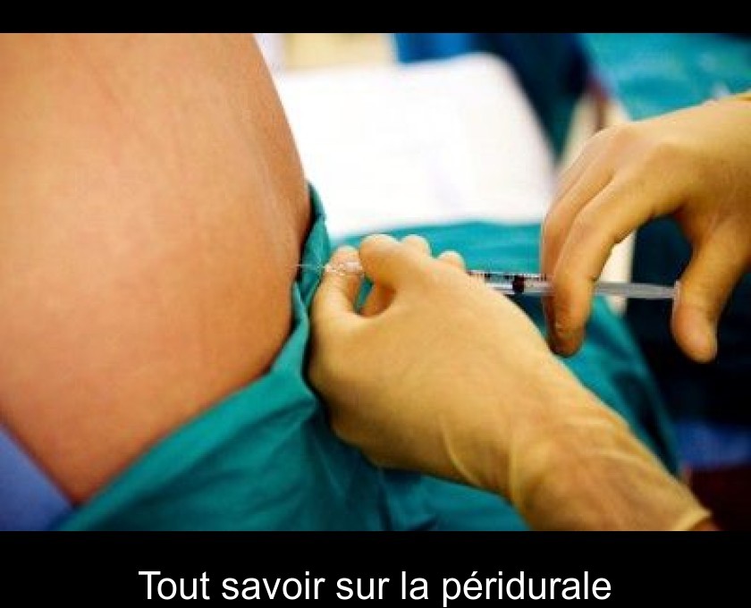 Tout savoir sur la péridurale Tout savoir sur la péridurale