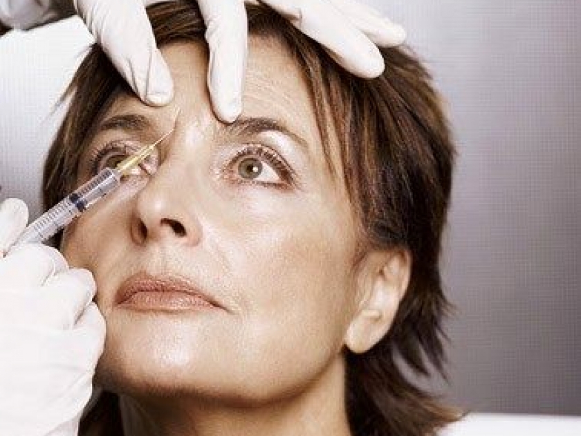 Tout savoir sur le botox Tout savoir sur le botox