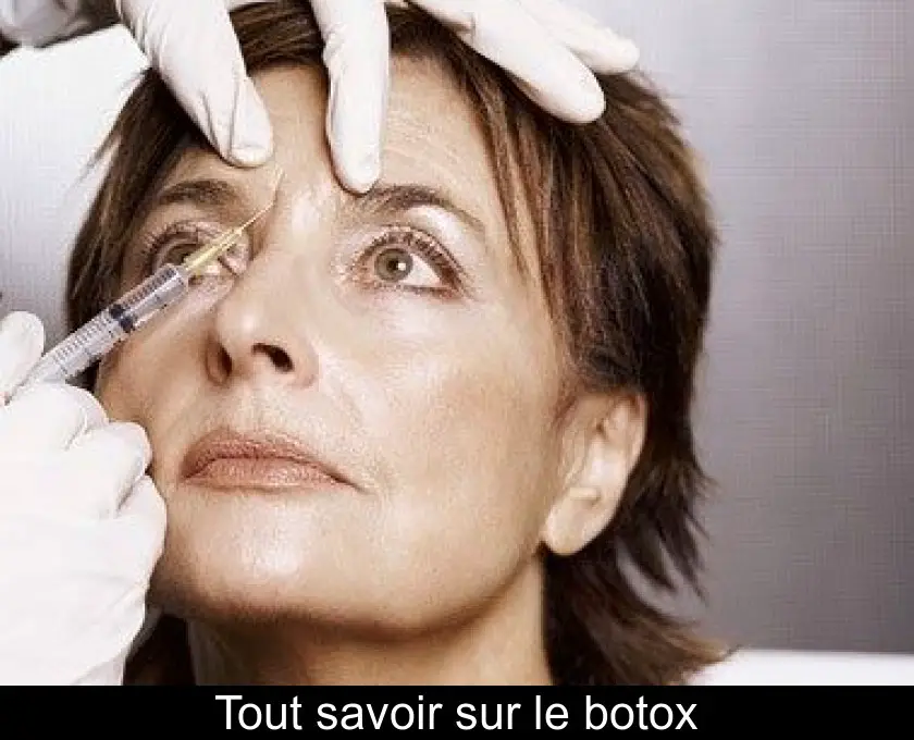 Tout savoir sur le botox