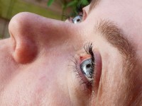 Blessure aux yeux : que faire ?