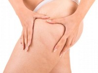 Cellulite : 5 choses à savoir pour un massage efficace