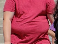 Chirurgie de l'obésité : les différentes techniques