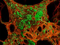 Comment se mettre soi-même en quarantaine si on est exposé au coronavirus