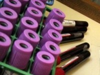 Comprendre les analyses de sang : guide pratique