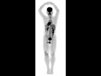 Innovation : un scanner 3D permet de visualiser le corps humain dans son ensemble